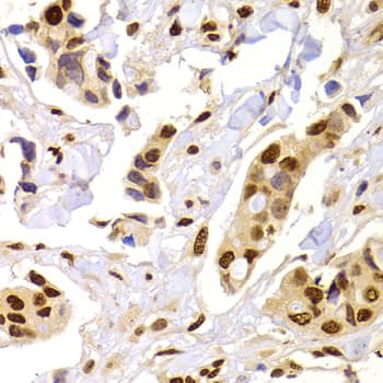 Polyclonal Rabbit anti-Human HNRPA1 / HnRNP A1 Antibody (IHC, IF, WB)