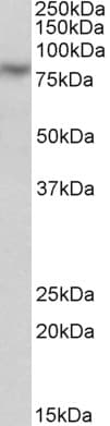 IHC-plus™ CAPN1 / Calpain 1 Antibody (aa468-481)