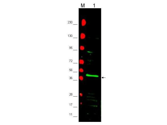 IHC-plus™ PPARG / PPAR Gamma Antibody