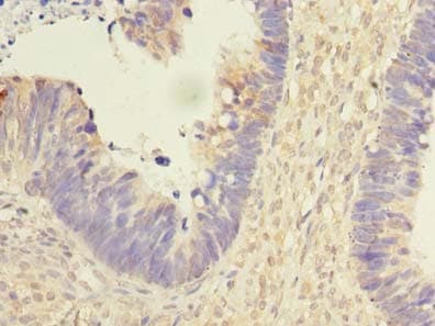 REEP2 Antibody