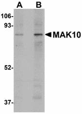 IHC-plus™ NAA35 Antibody