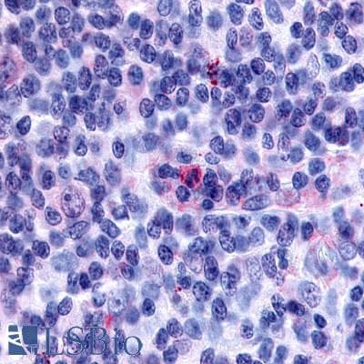 IHC-plus™ GPR65 / TDAG8 Antibody (Cytoplasmic Domain)