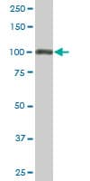 IHC-plus™ Monoclonal Mouse anti-Human TRIM28 / KAP1 Antibody (clone 1D11, IHC, WB)