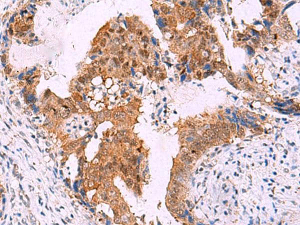 Polyclonal Rabbit anti-Human FKBP4 / FKBP52 Antibody (IHC, WB)