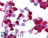 IHC-plus™ Polyclonal Rabbit anti-Human PTGER4 / EP4 Antibody (C-Terminus, IHC)