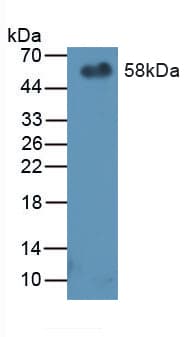 SERPINF1 / PEDF Antibody (aa19-389)