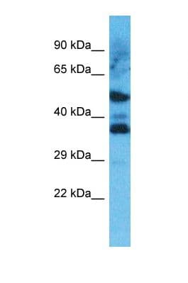 Polyclonal Rabbit anti-Human OR8D4 Antibody (C-Terminus, WB)