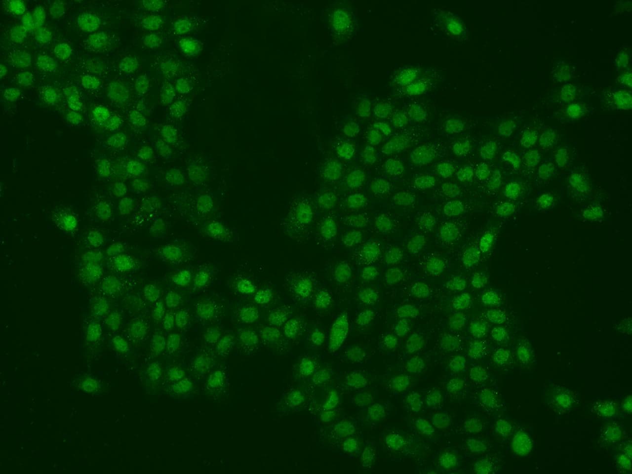 Polyclonal Rabbit anti-Human PPHLN1 Antibody (IF, WB)