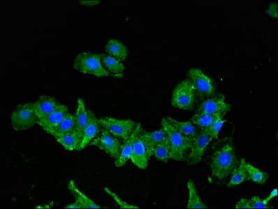 SEMA6A / Semaphorin 6A Antibody