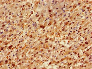SIP / TP53INP1 Antibody