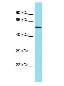 Polyclonal Rabbit anti-Human KLHL33 Antibody (aa162-211, WB)