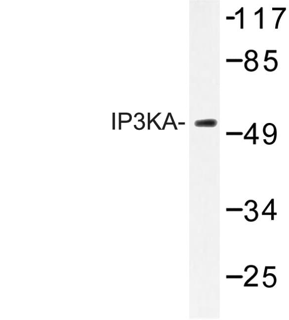 Polyclonal Rabbit anti-Human ITPKA Antibody (His431, WB)