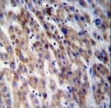 CPN1 Antibody (aa210-240)
