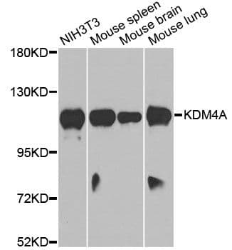 KDM4A / JHDM3A / JMJD2A Antibody