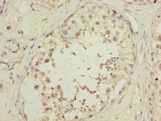 OOSP2 / PLAC1L Antibody