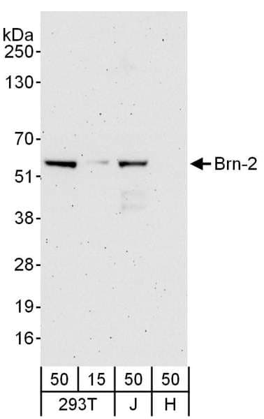 BRN2 / POU3F2 Antibody (aa393-443)