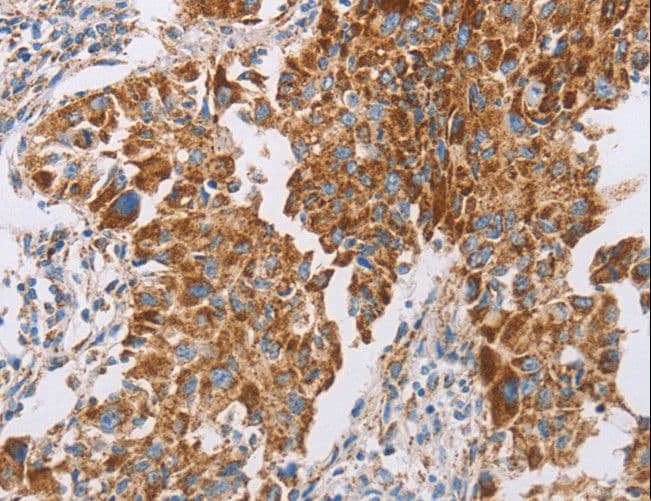 GUCY1A1 / GUCY1A3 Antibody