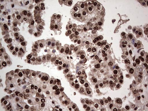 Monoclonal Mouse anti-Human SAE1 Antibody (clone OTI6B11, IHC, WB)