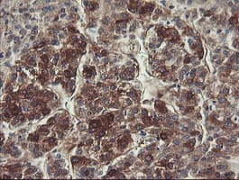 FTCD / 58K Golgi Protein Antibody (clone OTI4F5)