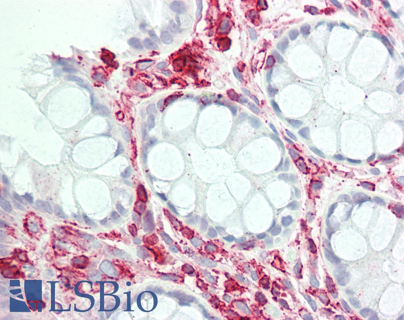 IHC-plus™ RNF4 Antibody (aa95-123)