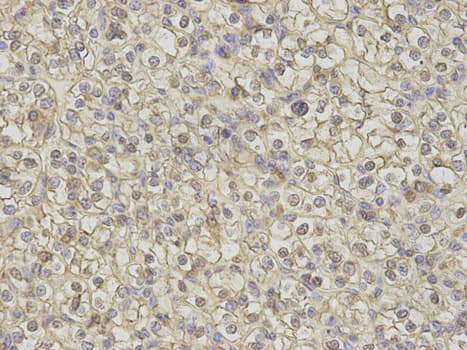 IHC-plus™ Calgizzarin / S100A11 Antibody