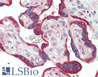 PathPlus™ ROS1 / ROS Antibody (aa1744-1777)