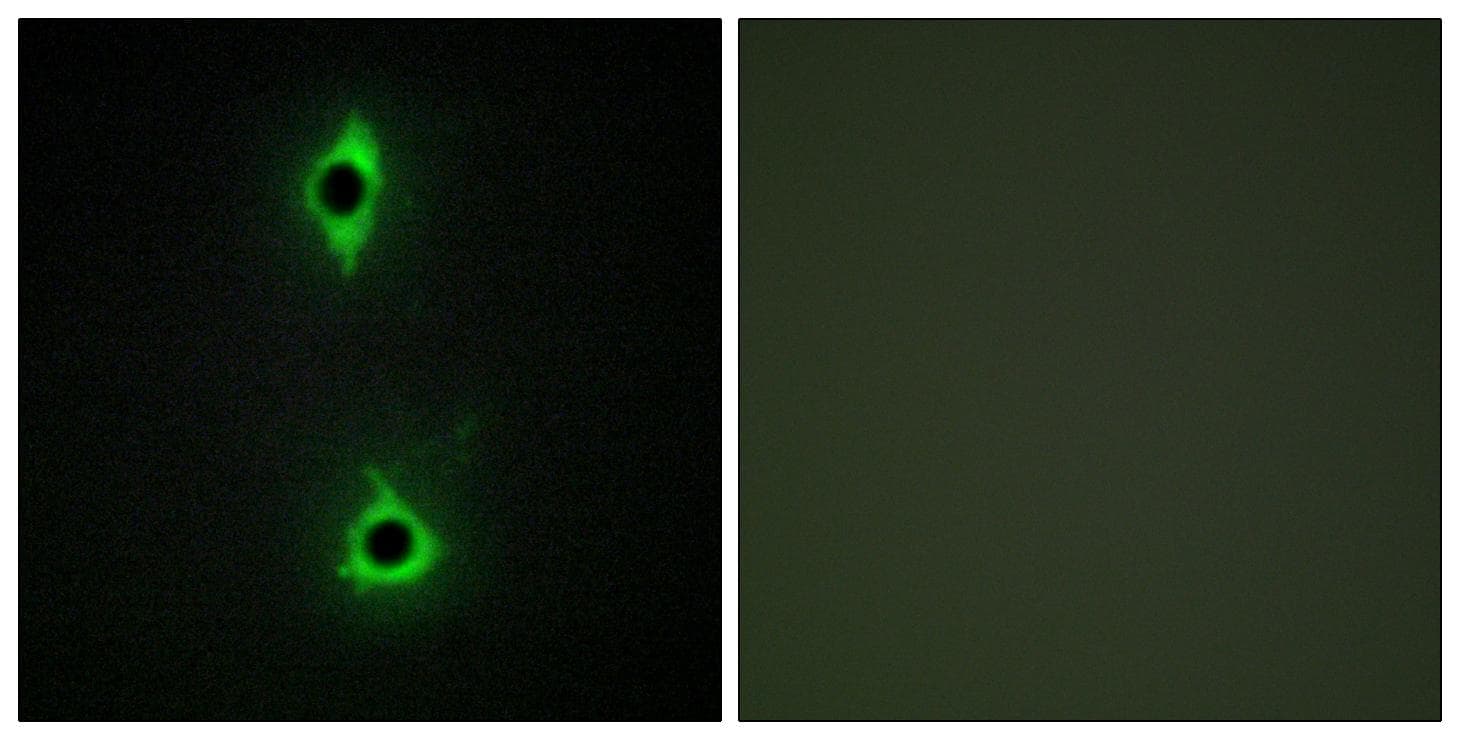 Polyclonal Rabbit anti-Human PIKFYVE / PIP5K Antibody (IF, WB)