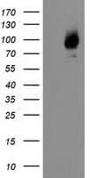 Monoclonal Mouse anti-Human MAC-2-BP / LGALS3BP Antibody (clone OTI6B7, IHC, WB)