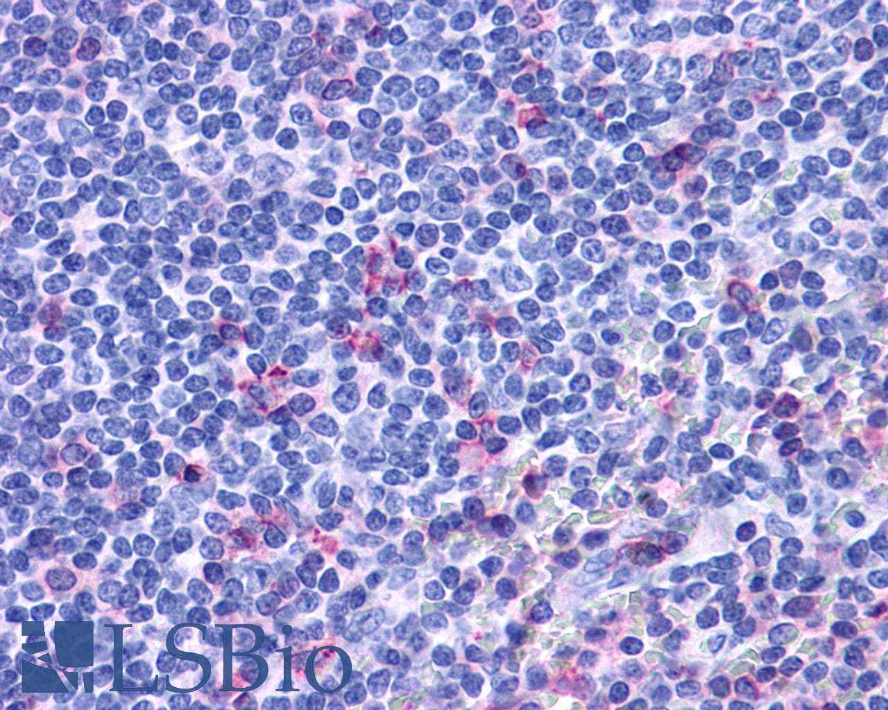 IHC-plus™ ACKR3 / CXCR7 Antibody