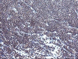 TPD52L3 Antibody (clone OTI3D11, Carrier-free)