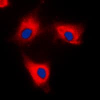 Polyclonal Rabbit anti-Human YWHAQ / 14-3-3 Theta Antibody (C-Terminus, IHC, IF, WB)