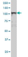 NFKB1 / NF-Kappa-B Antibody (clone 3F6)