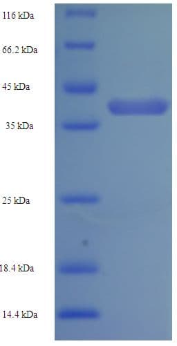 Human NAPSA / NAPA / Napsin A Protein (Recombinant His)