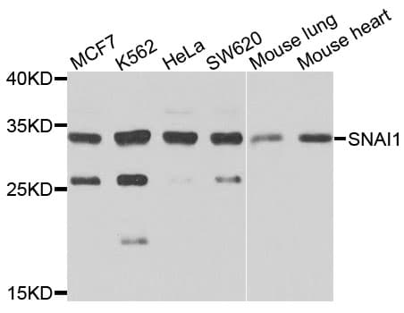 SNAI1 / SNAIL-1 Antibody