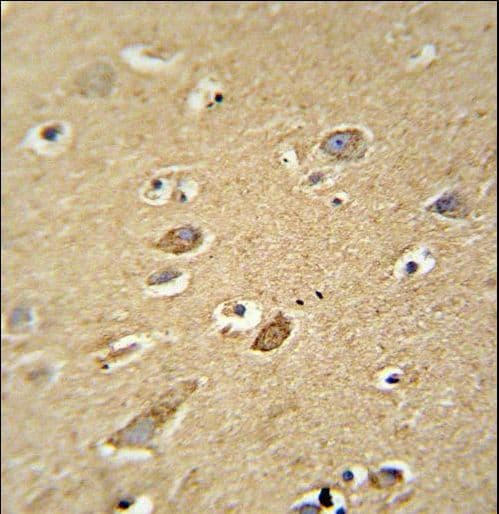 Polyclonal Rabbit anti-Human ATP5H Antibody (aa68-97, IHC, WB)