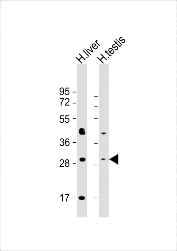 Polyclonal Rabbit anti-Human 5-Alpha Reductase / SRD5A1 Antibody (Internal, WB)