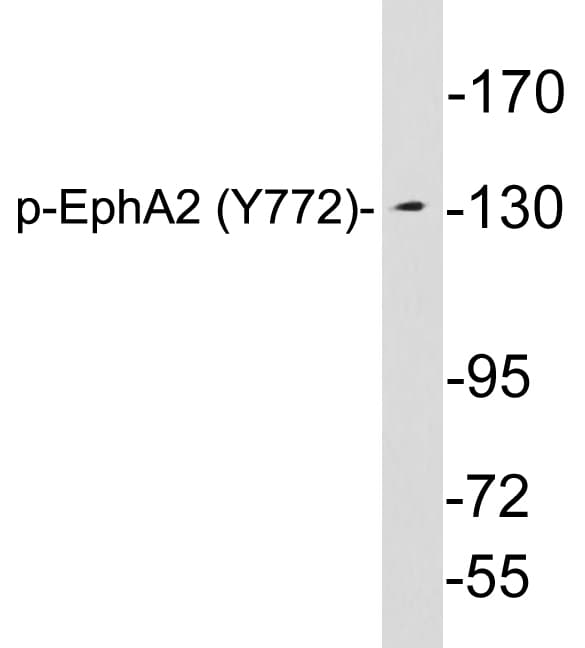 Polyclonal Rabbit anti-Human EPHA2 / EPH Receptor A2 Antibody (phospho-Tyr772, WB)