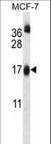 UBE2W Antibody (aa105-133)