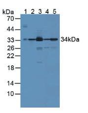 BLVRA Antibody (aa10-279, PE)