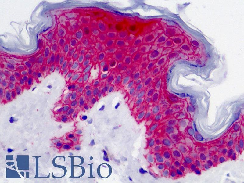 IHC-plus™ SDC1 / Syndecan 1 / CD138 Antibody
