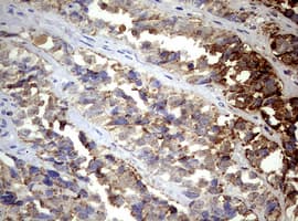 PIK3CD / PI3K Delta Antibody (aa286-610, clone OTI1D11)