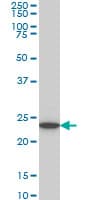 Monoclonal Mouse anti-Human UCHL3 Antibody (clone 4E9, WB)