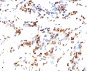 CDKN1B / p27 Kip1 Antibody (clone KIP27-1, Ready-to-Use)