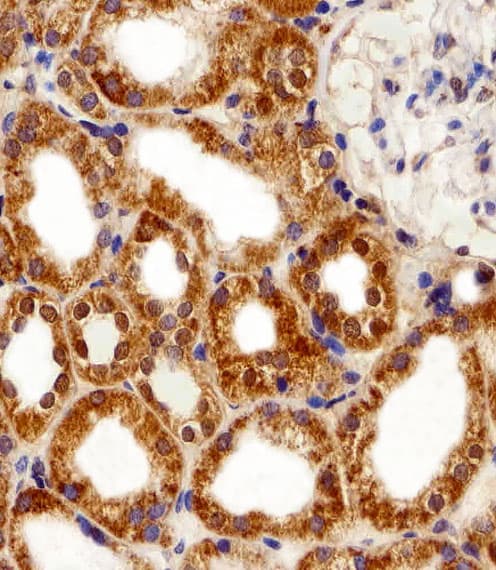 FBXL17 Antibody (aa262-297)