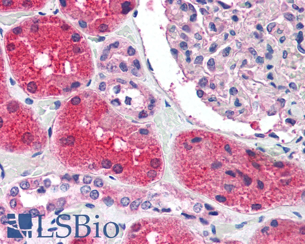 IHC-plus™ KCNN2 Antibody (C-Terminus)