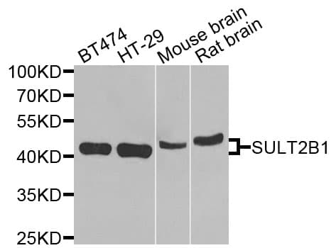 SULT2B1 / Sulfotransferase 2B1 Antibody