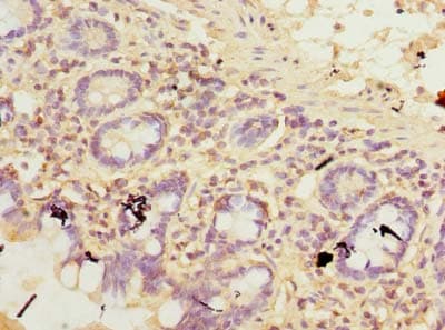 TCTEX1D2 Antibody