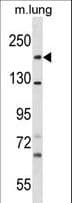 Polyclonal Rabbit anti-Human SNED1 Antibody (aa94-120, WB)