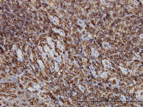Monoclonal Mouse anti-Human HCLS1 Antibody (clone 1A8, IHC, WB)