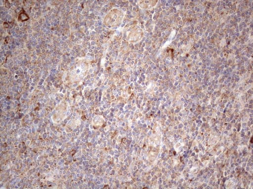 JAG1 / Jagged 1 Antibody (aa523-759, clone OTI3A10, Carrier-free)